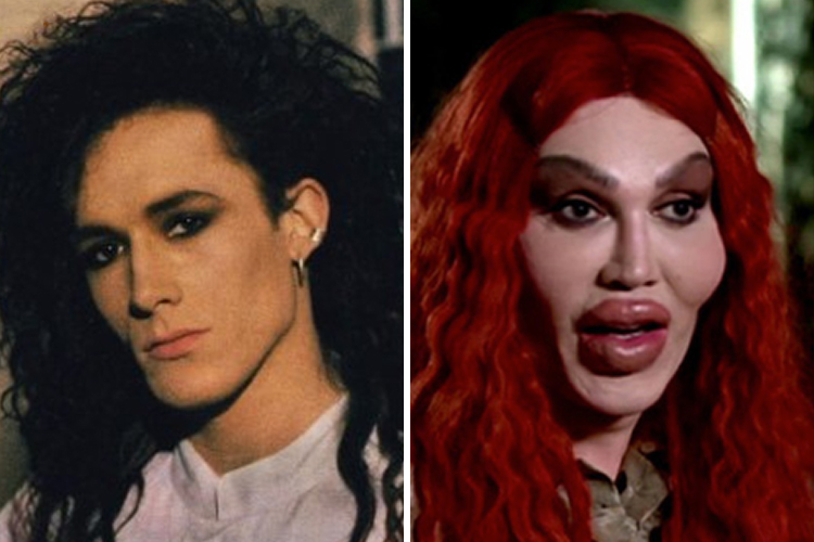 pete burns